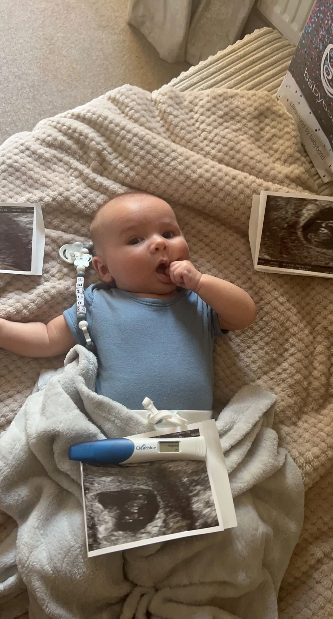 Image of patient story Gemma