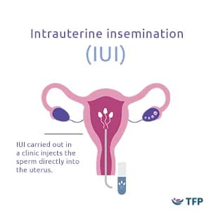 diagram of IUI