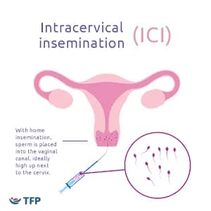 diagram of home insemination