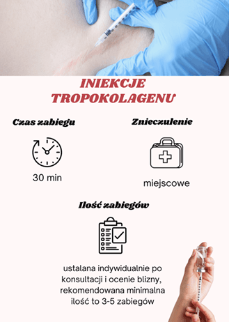 Iniekcje tropokolagenu