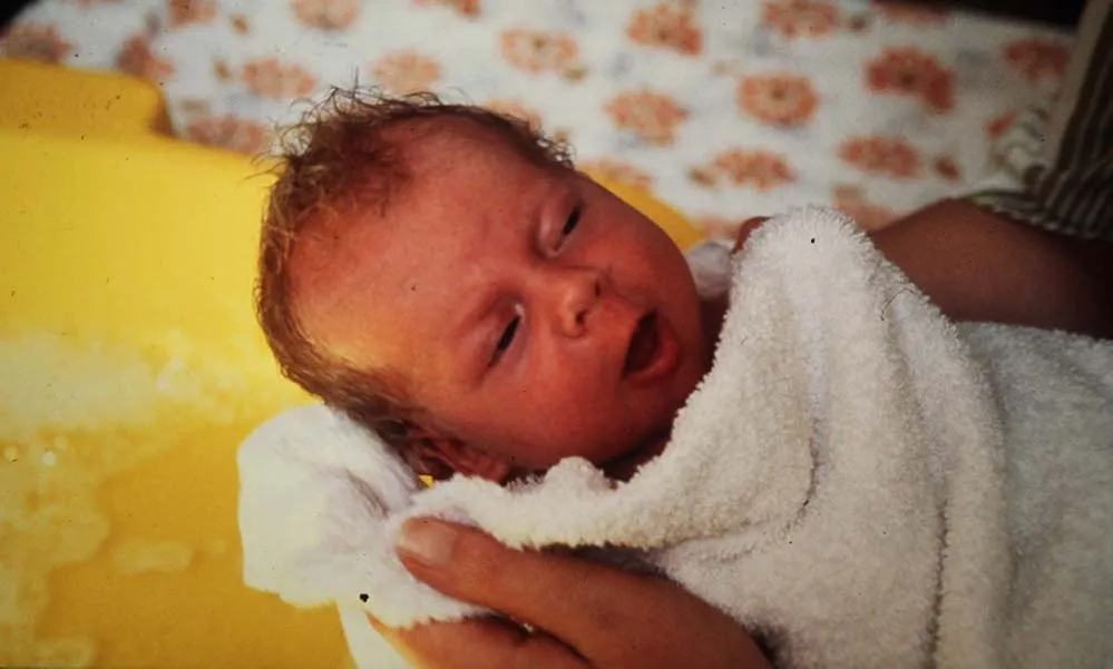 First IVFBaby Louise Brown TFP