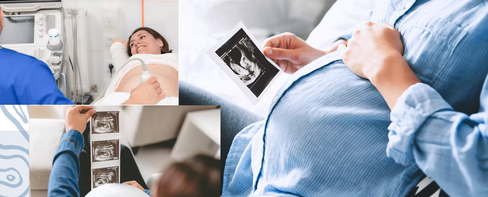 Donna incinta durante un'ecografia; Donna incinta che guarda le immagini di un'ecografia