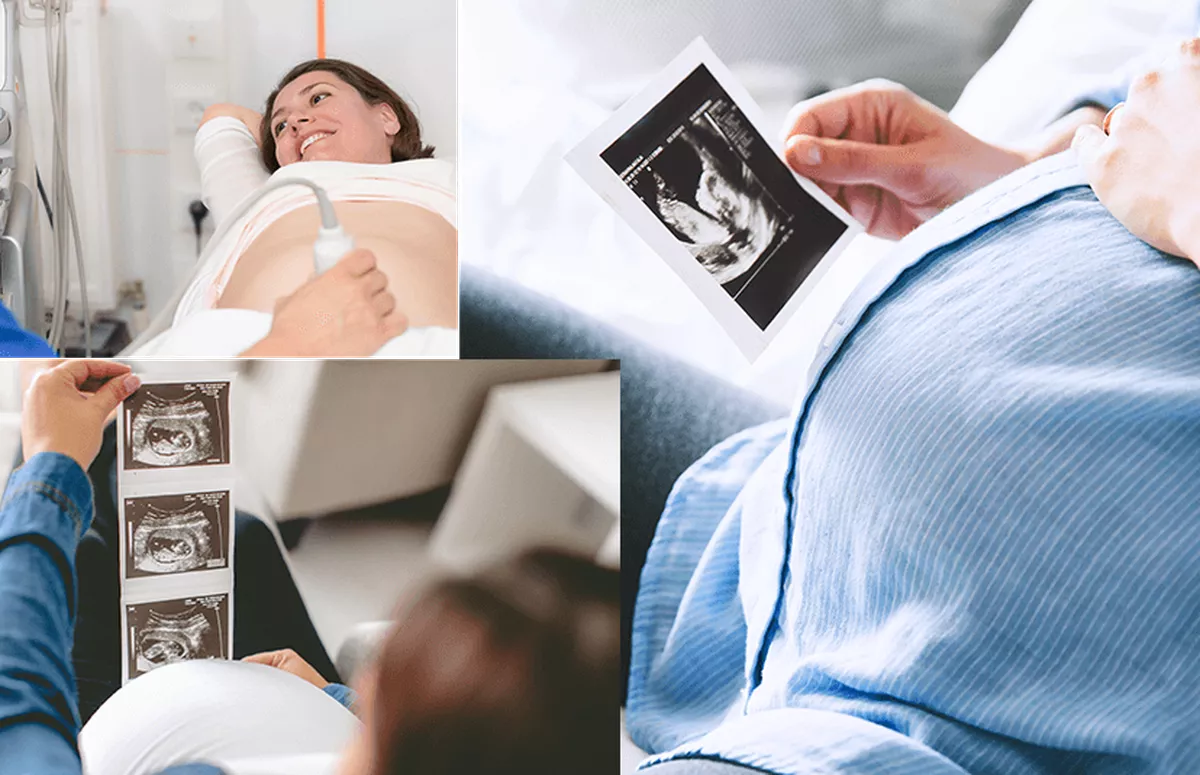 3D ultrasound for pregnancy